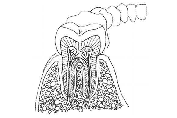 Anatomy of Teeth: A Designer's Real-World Embroidery Review